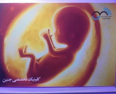 جنین