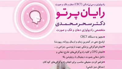 رایان پرتو