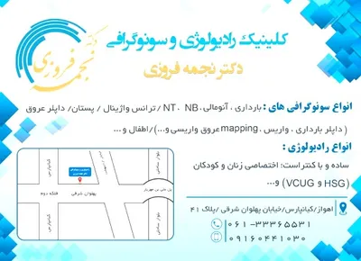 مطب مطب