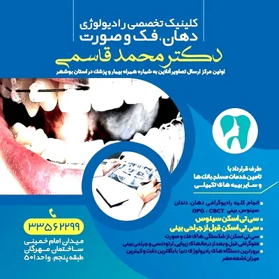 مطب