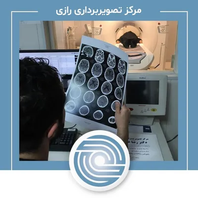 سی تی اسکن مرکز تصویربرداری رازی