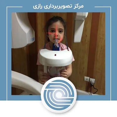 عکس دندان کودکان در مرکز تصویربرداری رازی