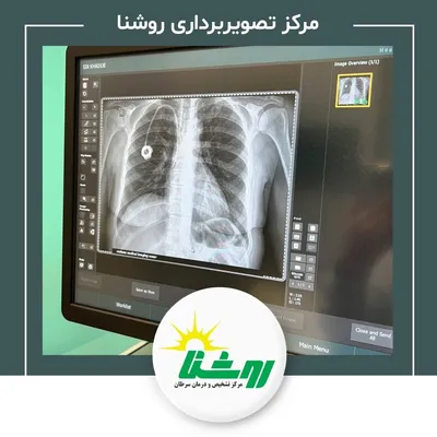 تصویربرداری پزشکی روشنا تصویربرداری پزشکی روشنا