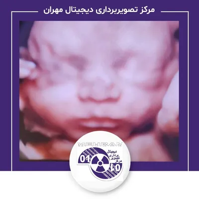نمونه کار