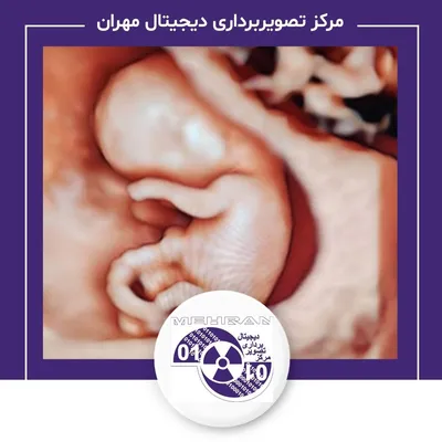 نمونه کار