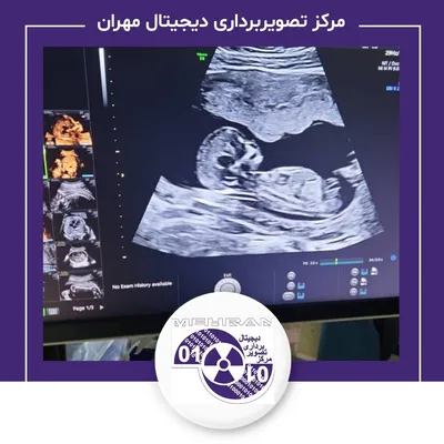 نمونه کار