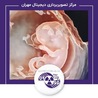 نمونه کار