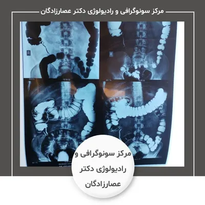 مرکز سونوگرافی و رادیولوژی دکتر عصارزادگان