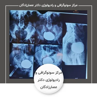 مرکز سونوگرافی و رادیولوژی دکتر عصارزادگان