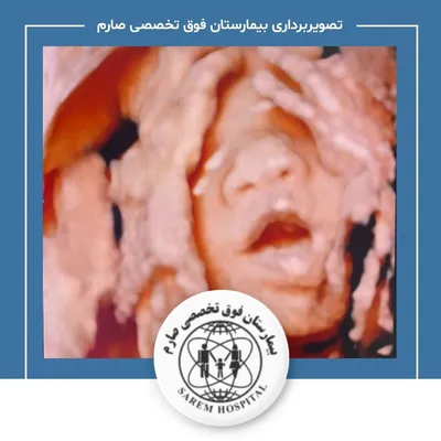 تصویر سه بعدی جنین