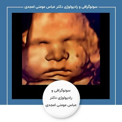 دکتر عباس مومنی امجدی