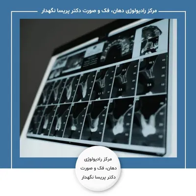 مرکز رادیولوژی دهان فک و صورت دکتر پریسا نگهدار اردبیل