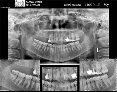 مرکز رادیولوژی دهان فک و صورت الماس تهران مرکز رادیولوژی دهان فک و صورت الماس تهران