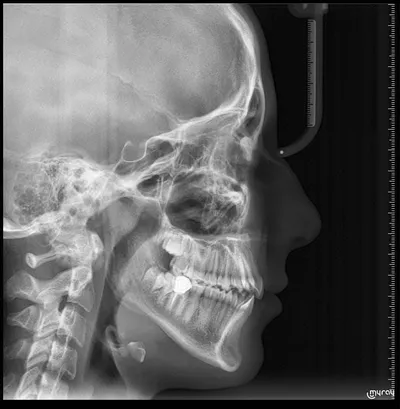 مرکز رادیولوژی دهان فک و صورت الماس تهران مرکز رادیولوژی دهان فک و صورت الماس تهران
