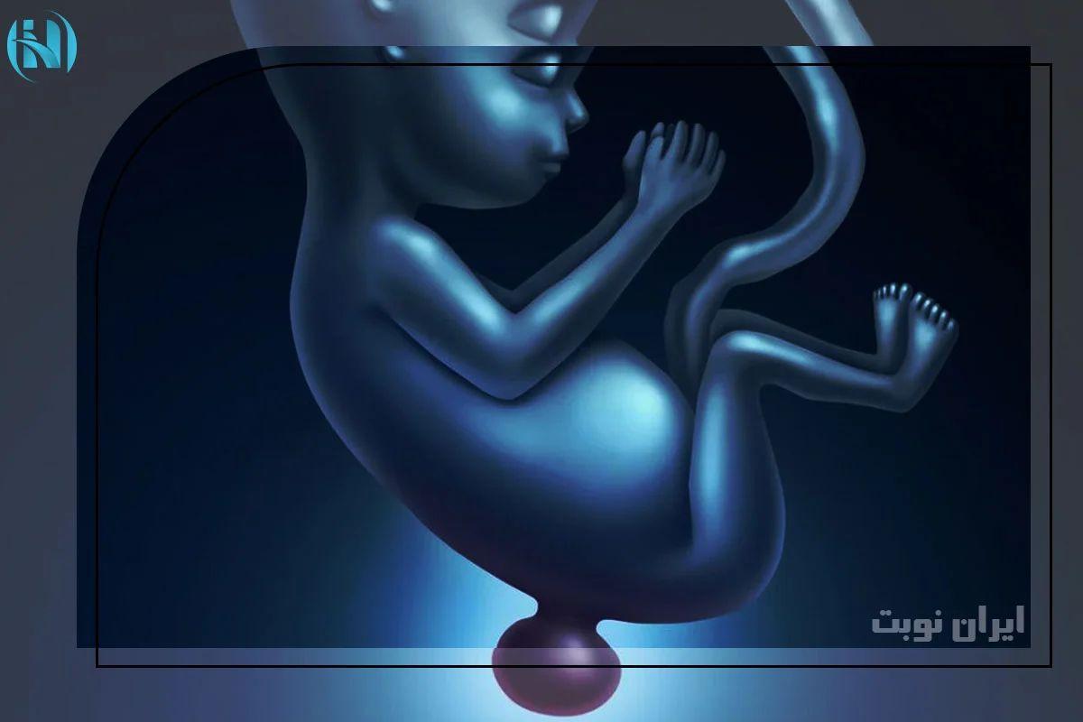 هر آنچه در مورد بیماری اسپینا بیفیدا باید بدانید