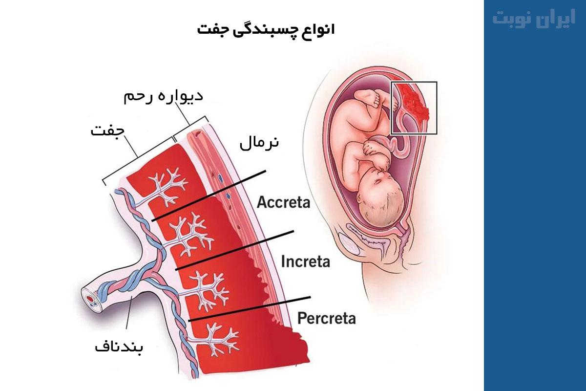 انواع