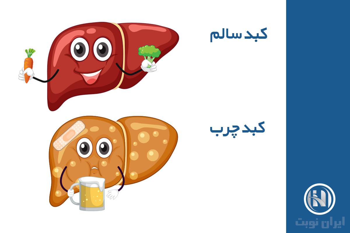 کبد چرب چیست؟ 