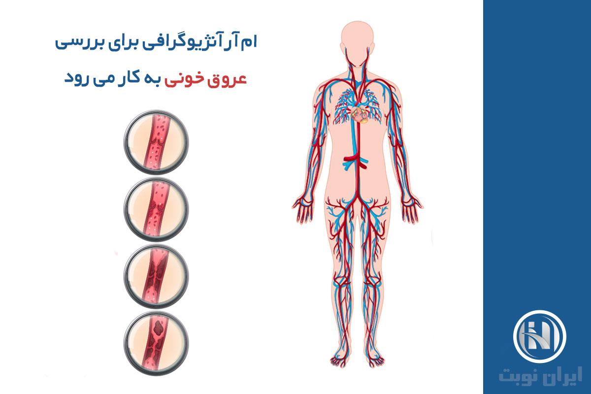 کاربردهای MRA و اهمیت انجام آن