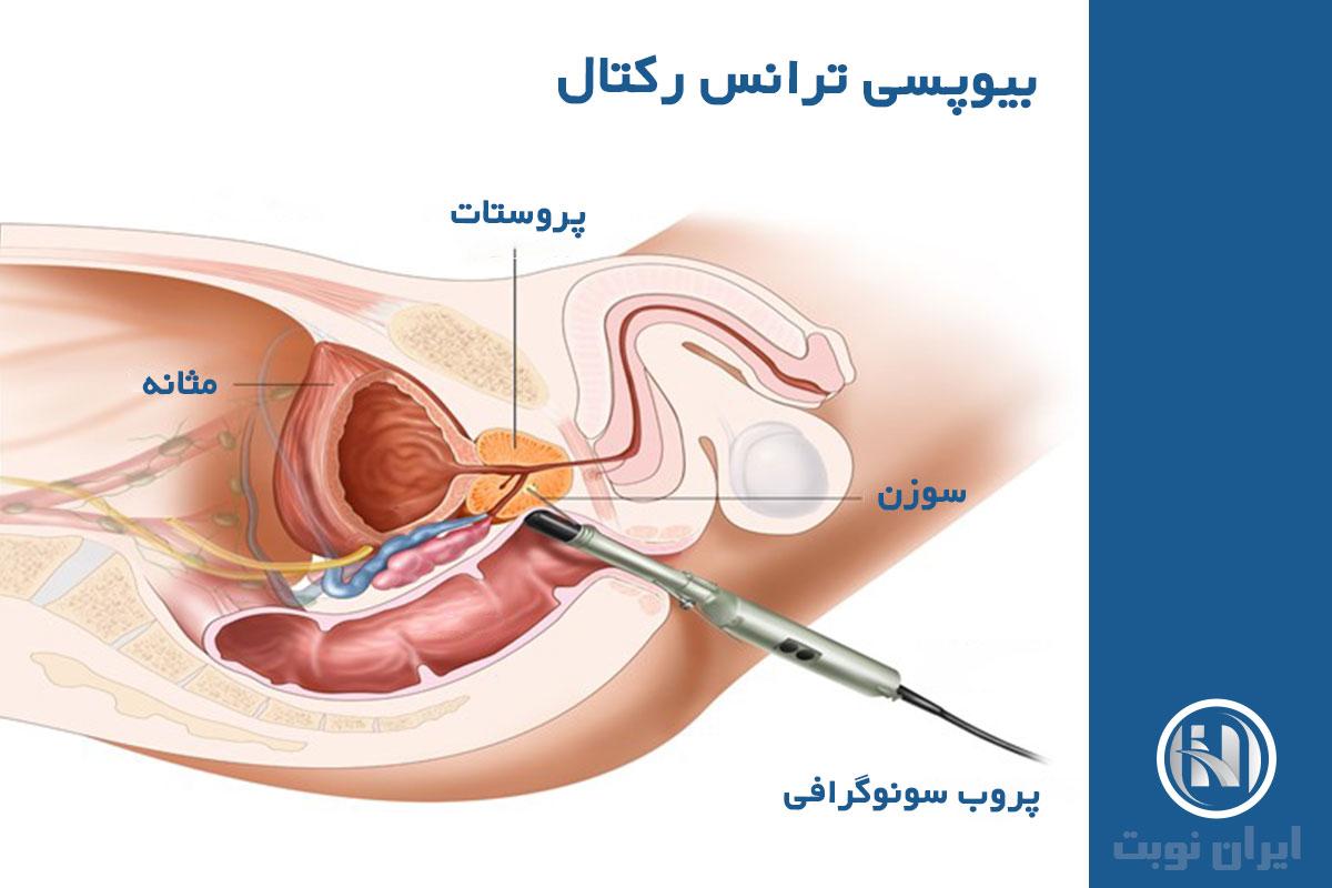 سونوگرافی شکمی و ترانس‌رکتال چه فرقی دارند؟