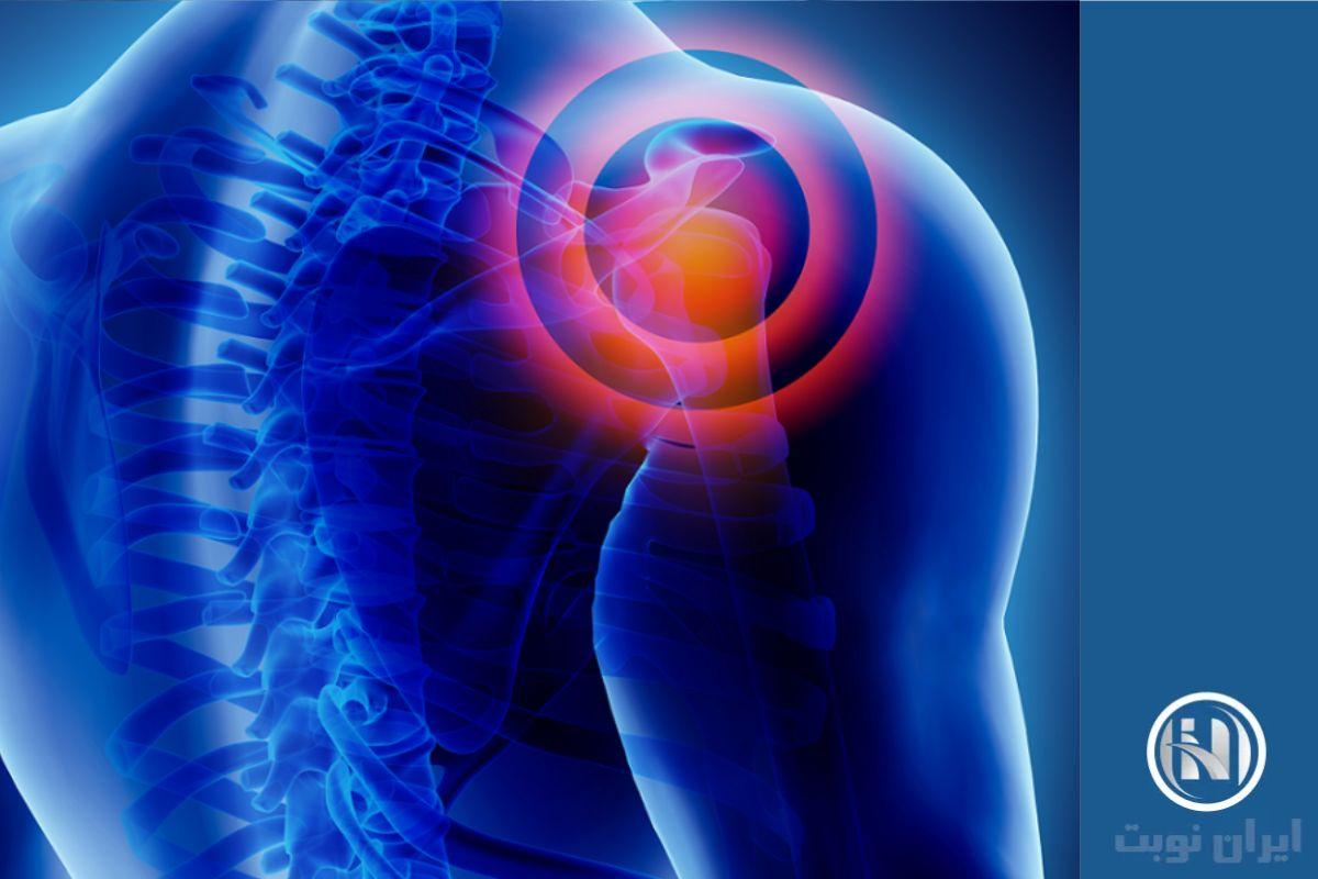 اصطلاحات تخصصی جواب shoulder MRI اصطلاحات تخصصی جواب shoulder MRI