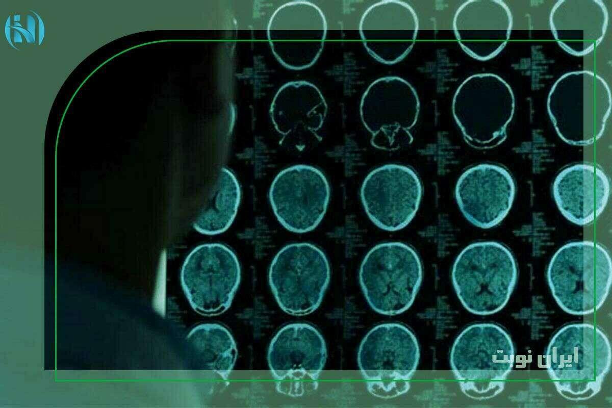 نحوه خواندن جواب ام آر آی؛ راهنمای جامع
