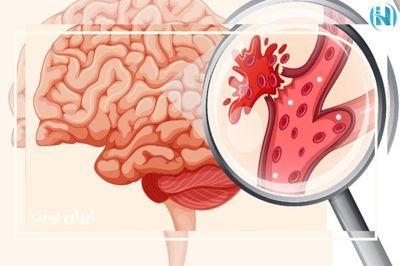 علائم خونریزی داخلی چیست؟ علائم خونریزی داخلی کدام‌اند و چه زمانی باید به پزشک مراجعه کرد؟