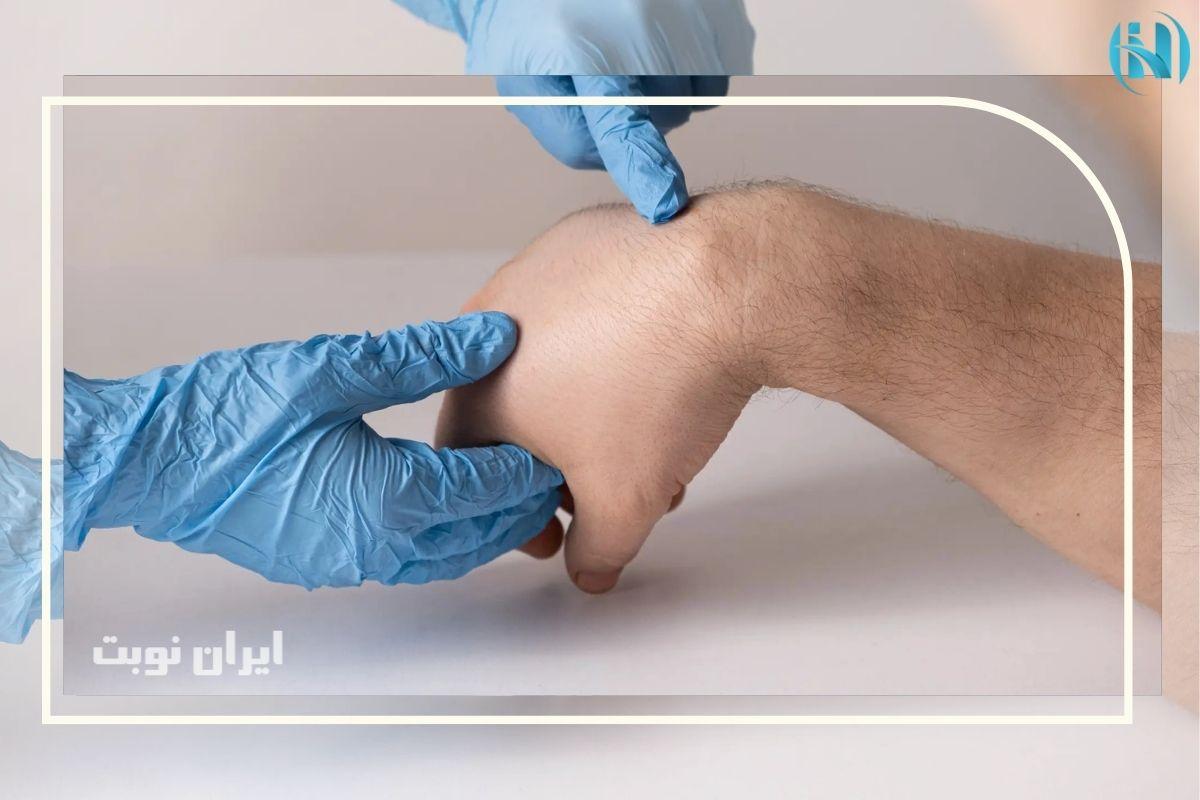 کیست گانگلیون مچ دست خطرناک است؟ آیا کیست مچ دست خطرناک است یا خطری ندارد؟