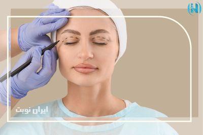 آیا عمل بلفاروپلاستی روی بینایی تأثیر دارد؟ بررسی واقعیت ها