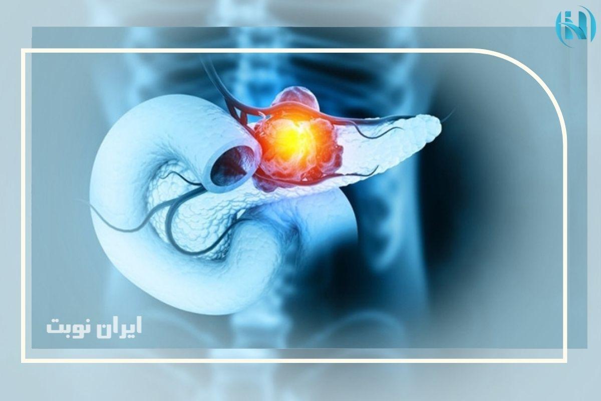 چه زمانی پانکراتیت اورژانسی محسوب می‌شود؟