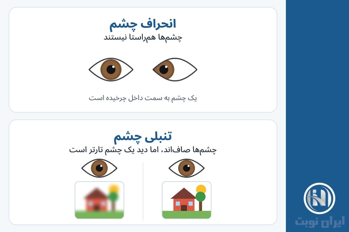 تنبلی چشم با انحراف چشم چه فرقی دارد؟