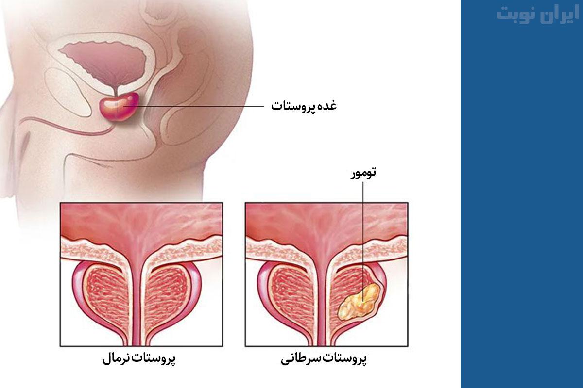 راه های تشخیص راه های تشخیص
