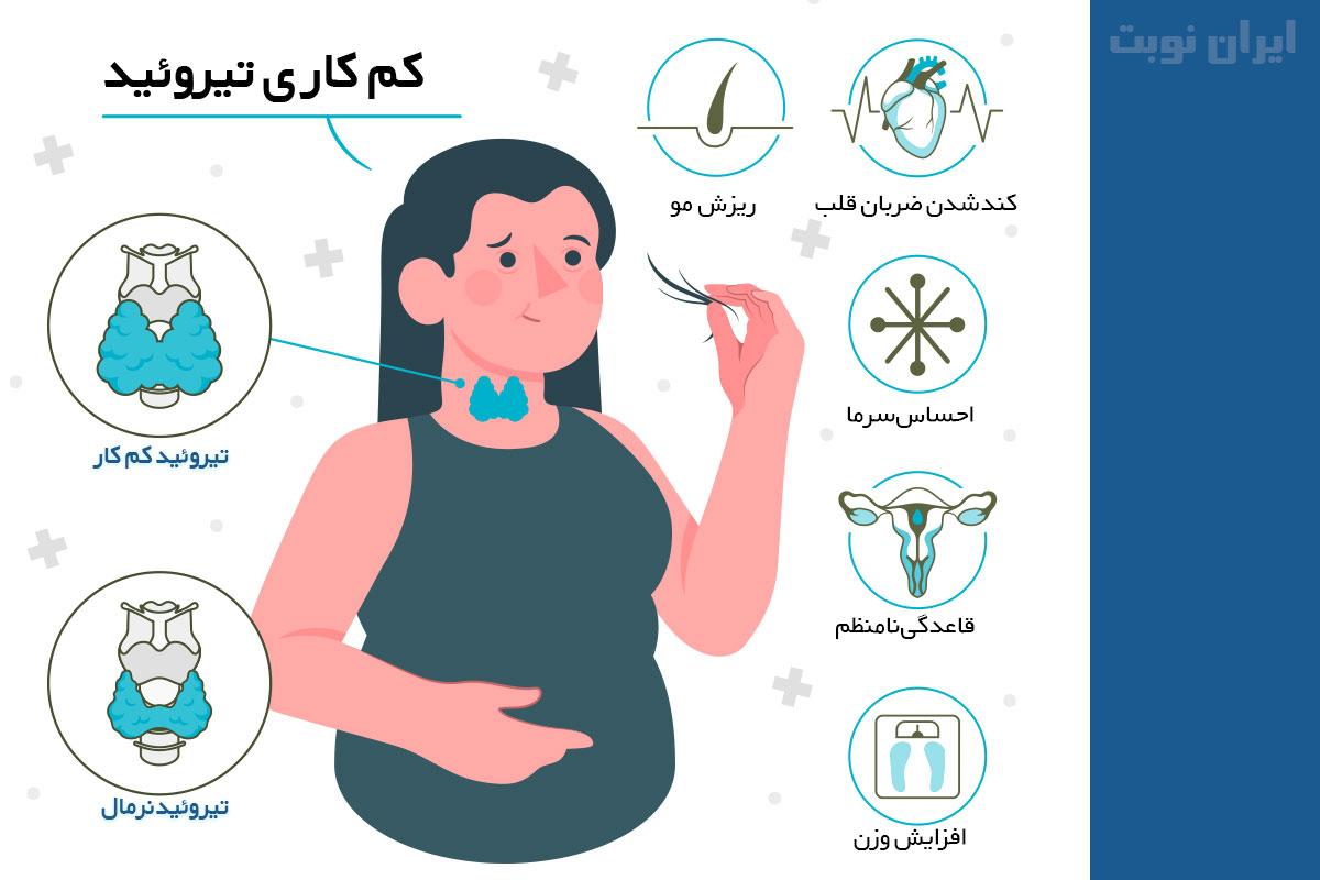علائم شایع کم کاری تیروئید علائم شایع کم کاری تیروئید