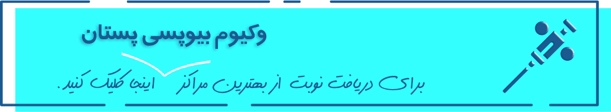 بعد از تست و مراقبت بعد از تست و مراقبت