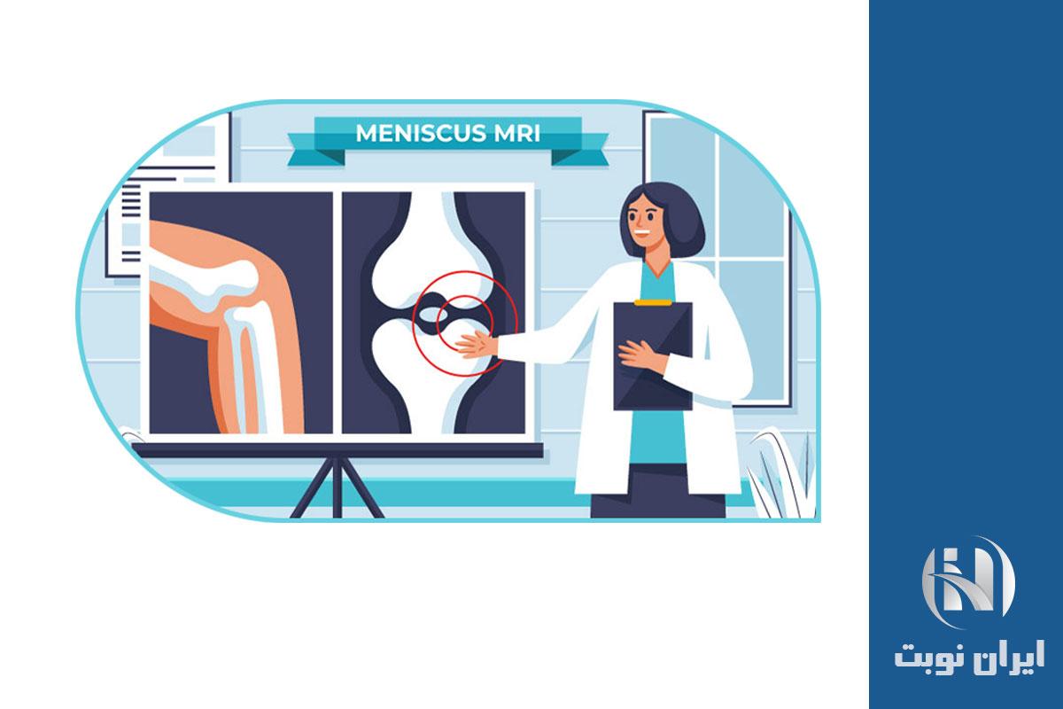 نحوه انجام MRI برای پارگی مینیسک نحوه انجام MRI برای پارگی مینیسک