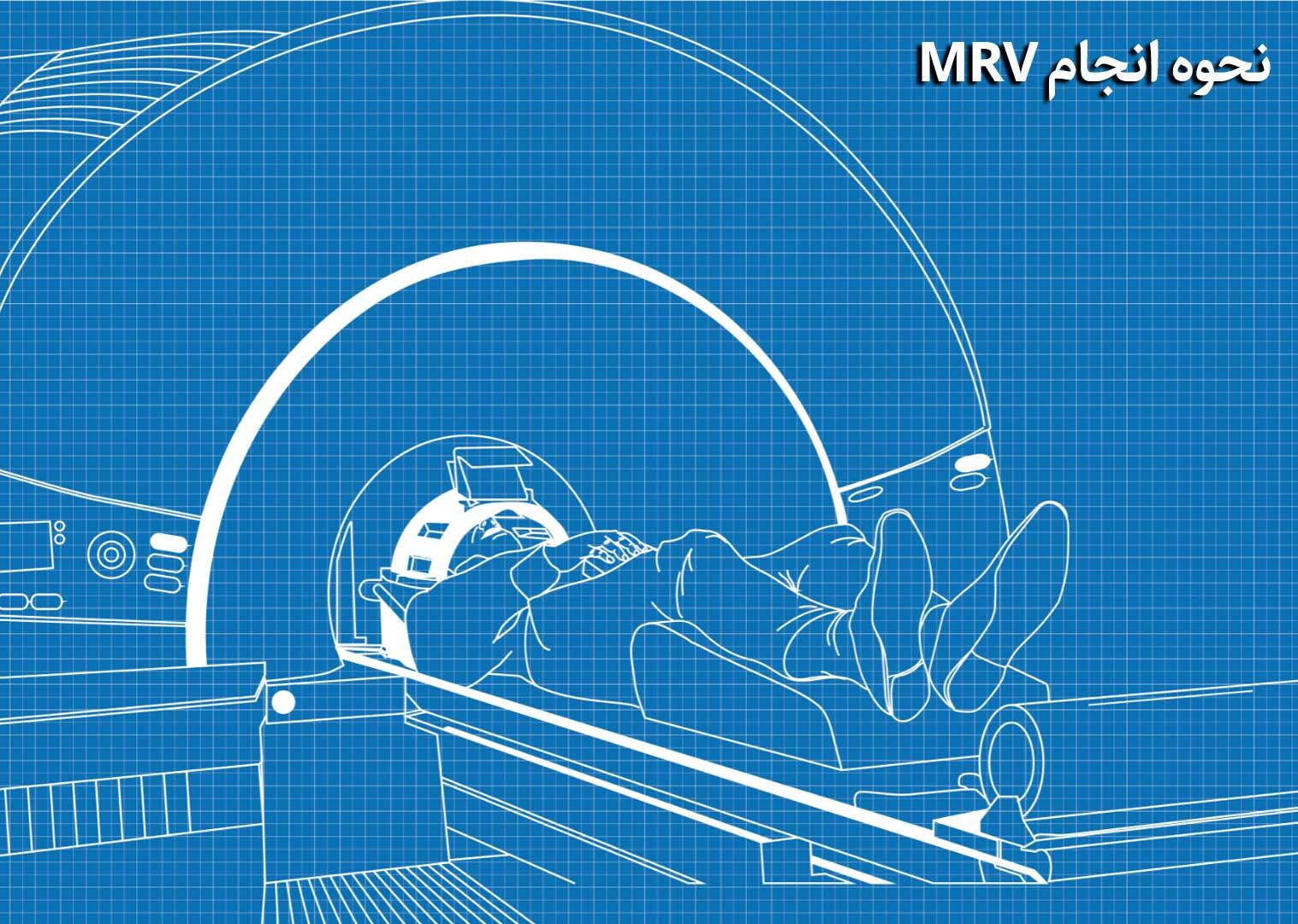 نحوه انجام MRV نحوه انجام MRV