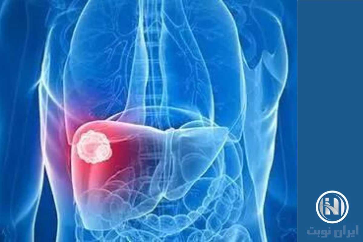 علائم liver failure علائم liver failure