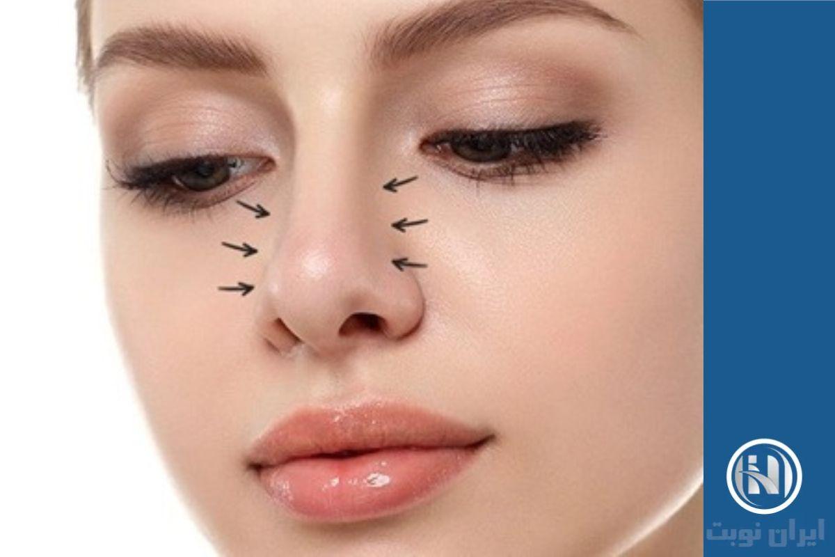 ویژگیهای پوست ضخیم و نازك بینی ویژگیهای پوست ضخیم و نازك بینی