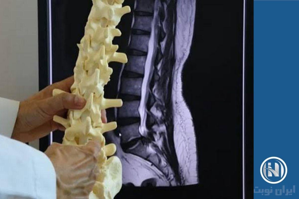 پزشکان از چه روشهایی برای تشخیص کمردرد استفاده میکنند؟ پزشکان از چه روشهایی برای تشخیص کمردرد استفاده میکنند؟