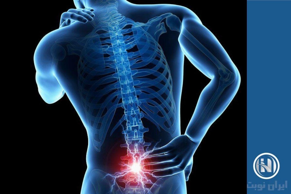 چگونه کمردرد شدید را درمان کنیم؟ چگونه کمردرد شدید را درمان کنیم؟