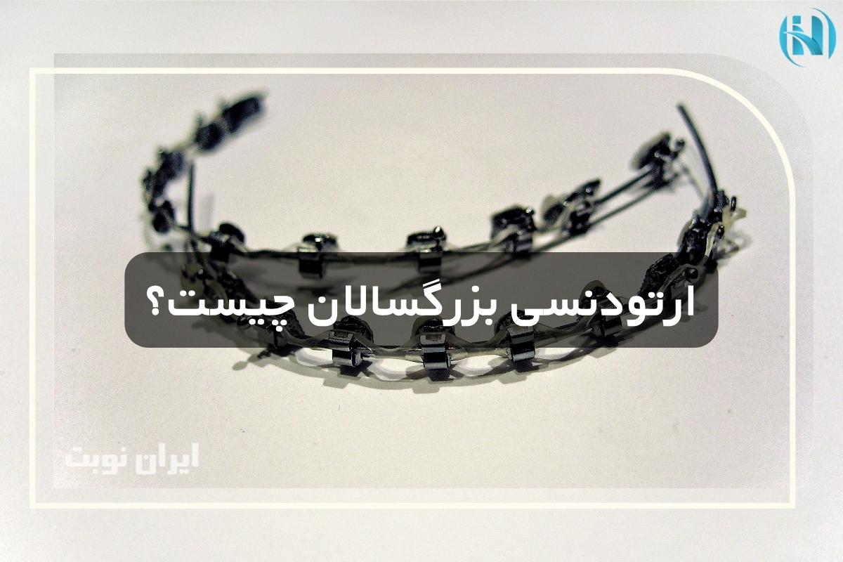 ارتودنسی بزرگسالان چیست و برای چه کسانی مناسب است؟ ارتودنسی بزرگسالان چیست و برای چه کسانی مناسب است؟