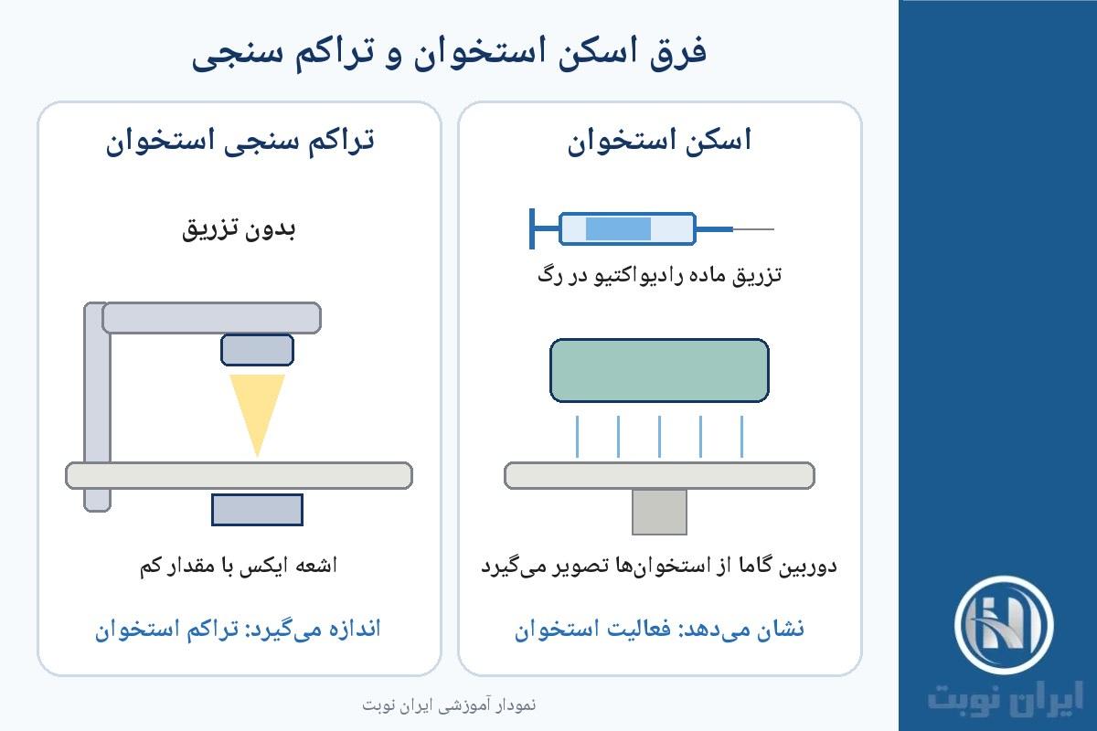 فرق اسکن استخوان با تراکم سنجی استخوان فرق اسکن استخوان با تراکم سنجی استخوان