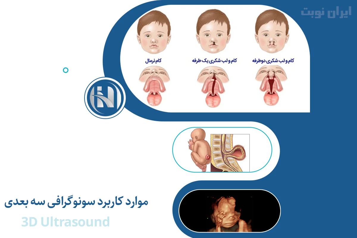 موارد کاربرد 