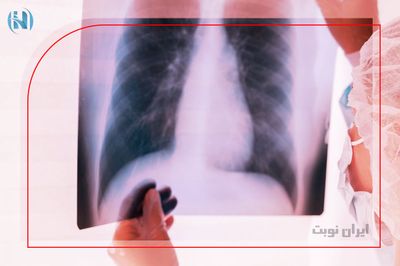 آمبولی ریه چگونه تشخیص داده می شود؟