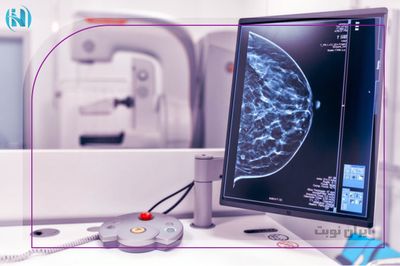 توموسنتز یا ماموگرافی سه بعدی پستان را به طور کامل بشناسید