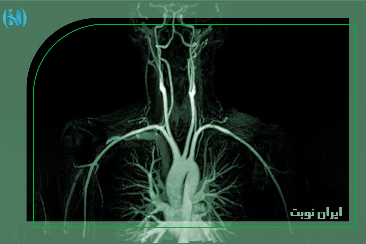 ام آر آنژیوگرافی چیست و چه کاربردی دارد؟