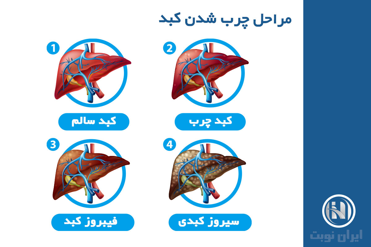 چرا کبد سیروزی می شود؟