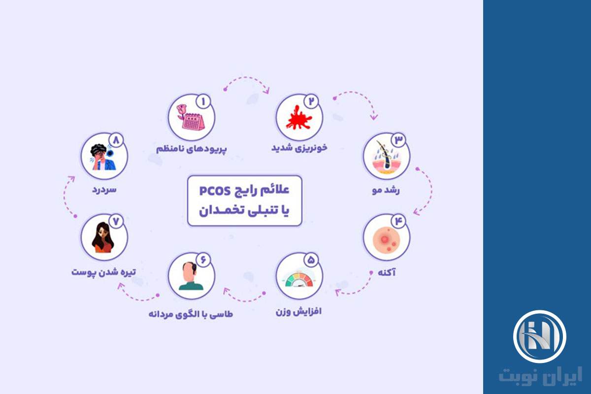 علائم تنبلی PCOD