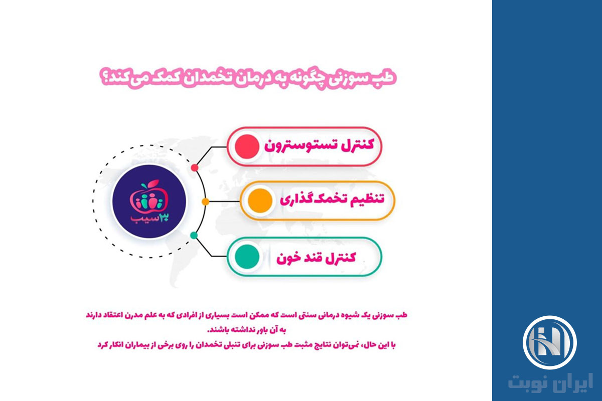 روش های درمانی تخمدان پلی کیستیک 