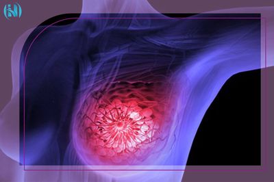 سونوگرافی سینه ابزاری قدرتمند در جستجوی سلامتی 
