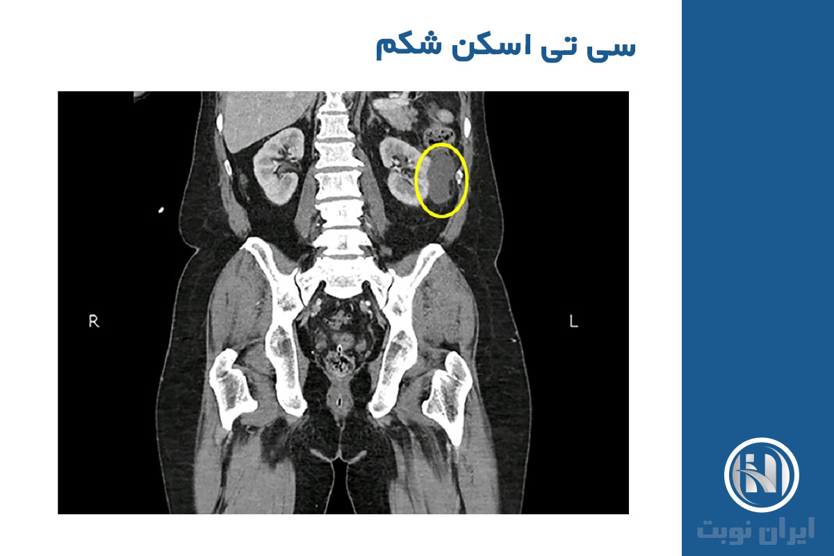 چرا پزشکان به سی تی اسکن اعتماد دارند؟